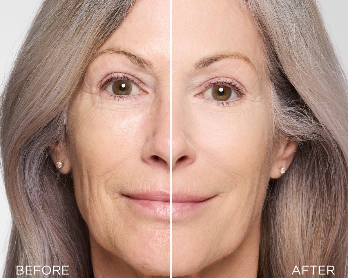 The Best Concealers for Mature Skin That Won’t Crease or Settle Into Fine Lines