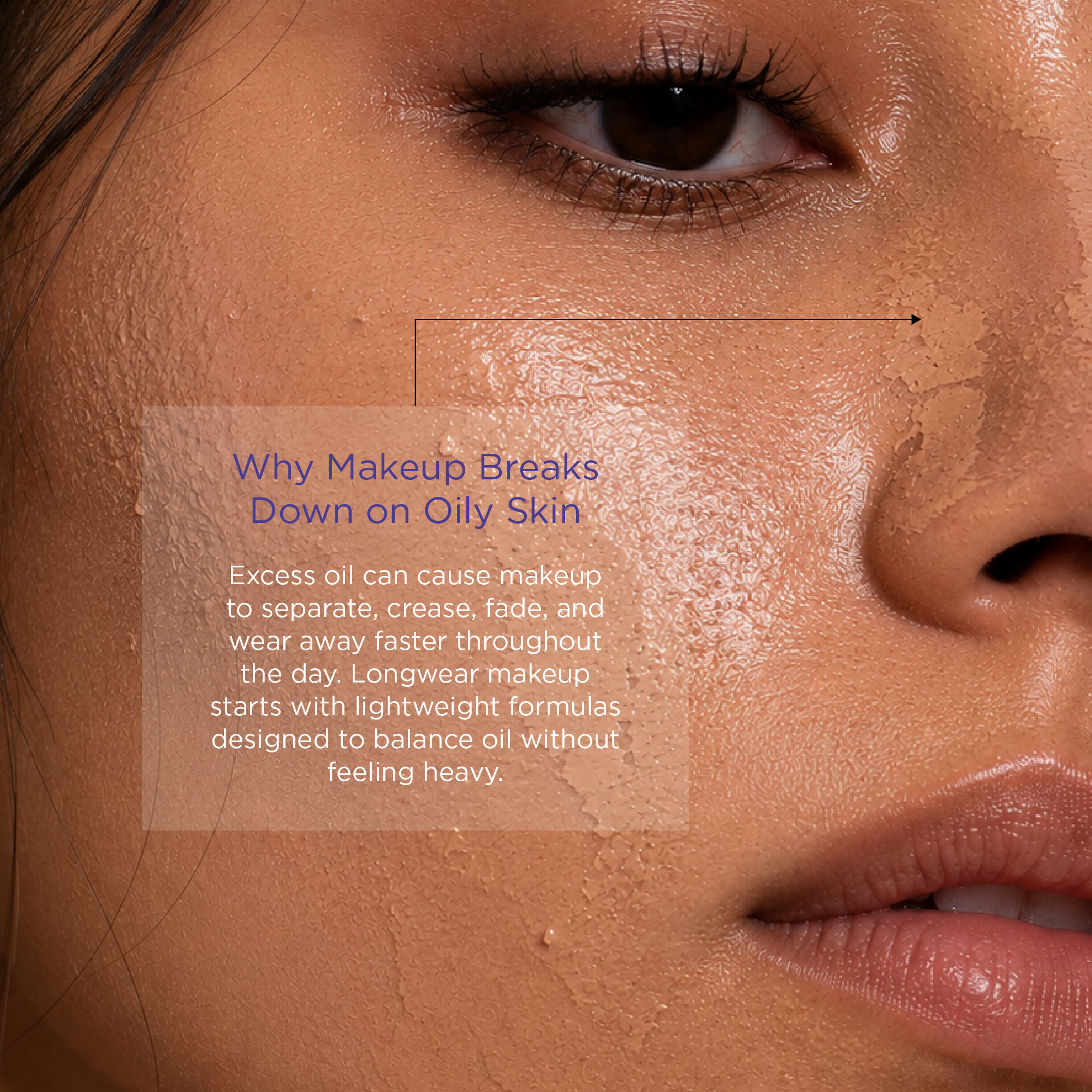 Oily_Skin_Landing_Page_Accordion_Assets-01.png